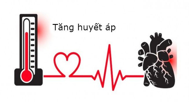 Tăng Huyết áp – Kẻ giết người thầm lặng