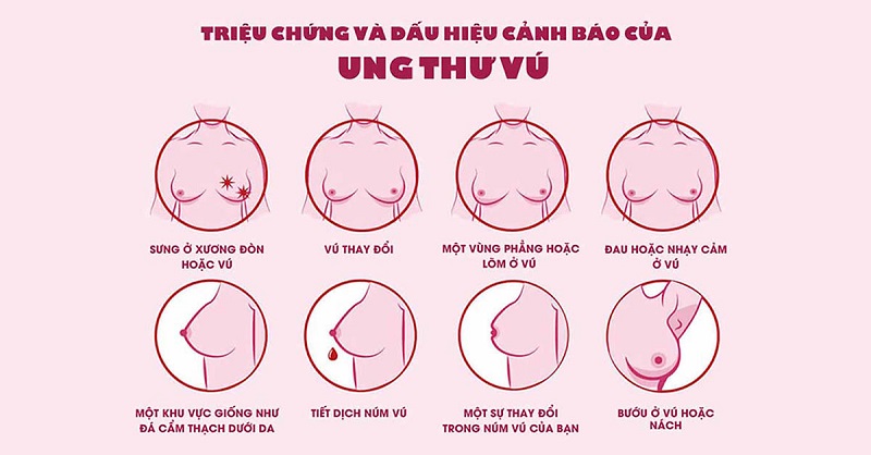 ung thu vu