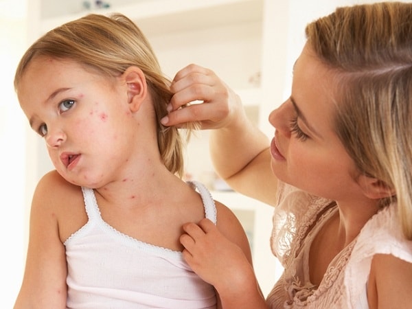 Bệnh vảy phấn hồng chữa trị thế nào?