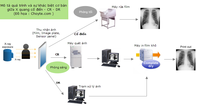Bản chất tia X và cấu tạo - nguyên lý hoạt động của máy X-quang