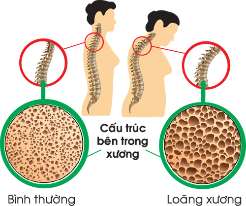 Vai trò canxi với sức khỏe