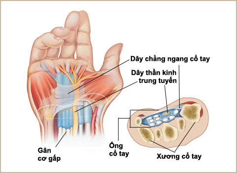 phong va dieu tri te tay ra sao